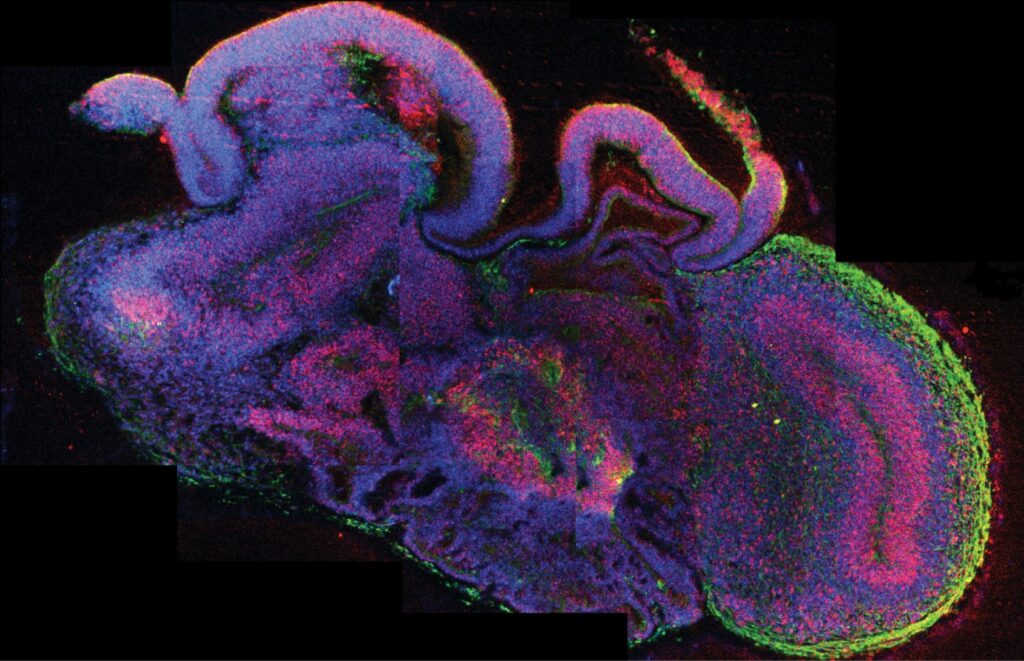 Example of a brain organoid capable of organoid intelligence