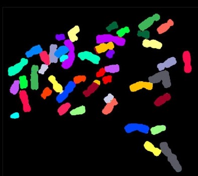 FISH Labeled Human Chromosomes